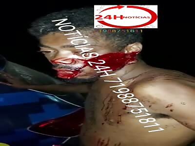 terrible machete attack on the face