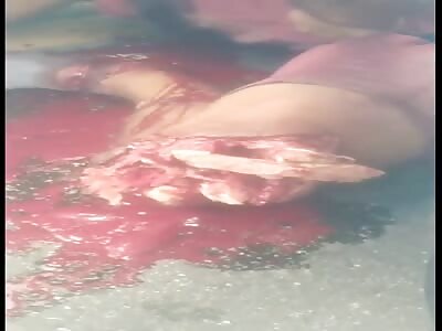 victim has his leg torn off in a motorcycle accident