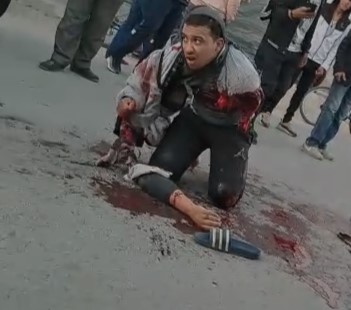 Would You Even Want to be Alive after This? He Is