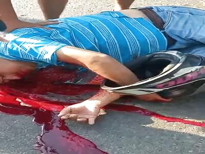 victim bleeds after being shot