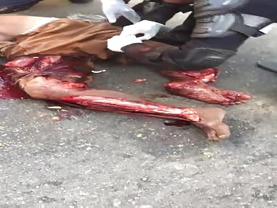 Omg, victim haver legs crushed