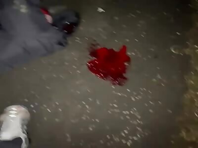 Crackhead was beaten.