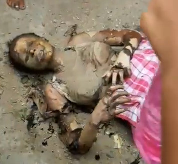 Student Girl Set on Fire by Ex-Boyfriend  