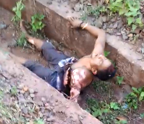 Electrocuted Cable Thief Still Talking