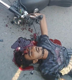 Bloody Murder Scene #90000