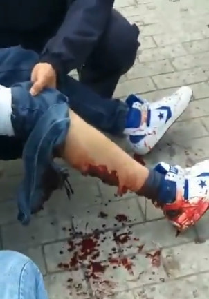 Dirty Converses Show ALOT More Style 