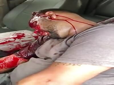 Man dying from gunshot to the head.