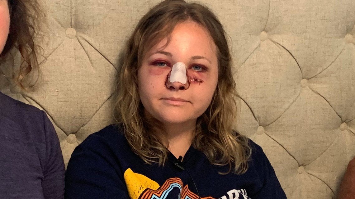 Gresham Woman Shot In the Face While Running Errands.