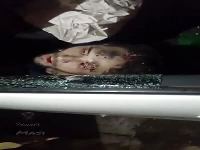 Man reached by assassin