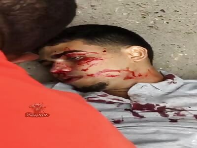 Unusual autopsy for this body.