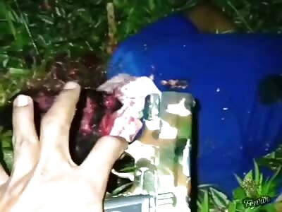 Dude Absolutely Mutilated by Machete.