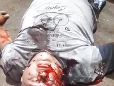 Gunshot victim lies dying in the street.