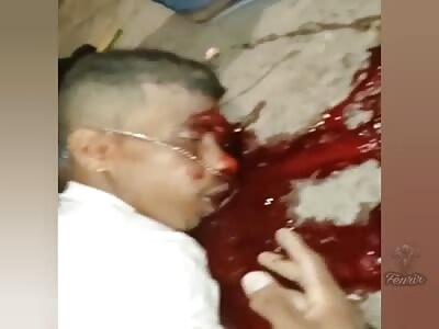 motorcyclist falls breaking his head