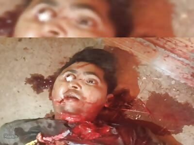 Eye See What You Did There (FUCKED UP)