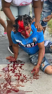 DAMN! Practically Scalped by Machete (Better Quality)