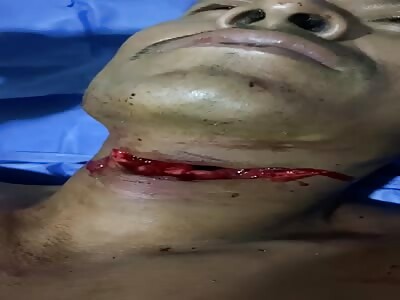 Throat Sliced For Being In the Wrong Bar