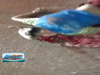 Brain Splatter After Motorcyclist Meets Truck Wheels