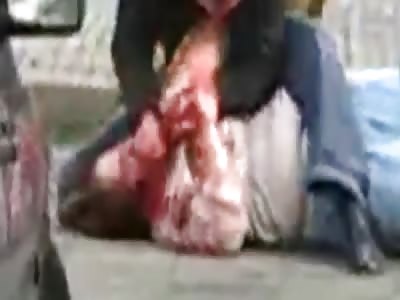 Woman Stabbed 70 Times By Ex