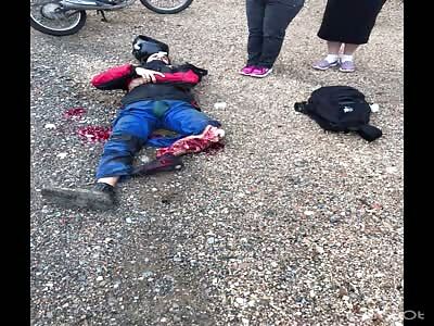 Man loses leg in motorcycle accident, Brazil.