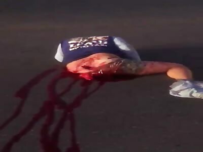 Truck accident, man ripped apart.