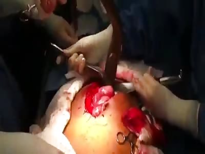 electric eel in the ass