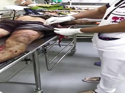 Bank robber after view Police 