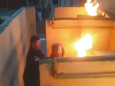 Coward Attacks Girl With Fire