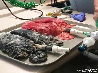 BIZARRE EXPERIENCE :smoker's lung and nonsmoker's lung