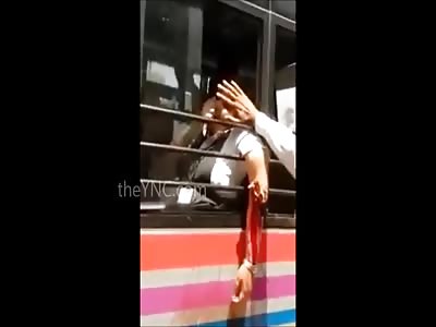 This What Happens When You Don't Keep Your Arm Inside the Vehicle.