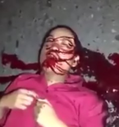 Man Agonizes in His Own Blood Beside Dead Friend