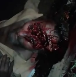 Man still Agonizing (Head Crushed by Stick Blows)