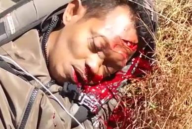 Horrible Scene: Man Bleeding Profusely by Nose and Mouth after Accident