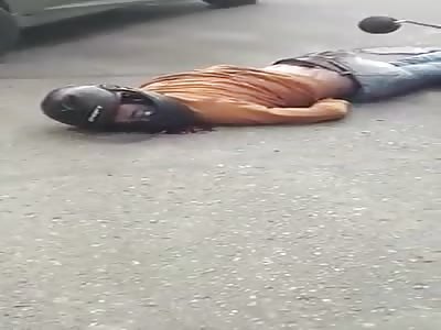 Biker's eye popped out.