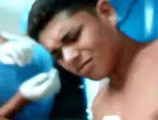 Removing a Bullet from inside a Kid's Chest..Bullet Stuck inside the Shirt 