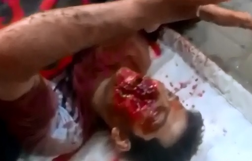 Man Shot int he Face tries Communicating with Sign Language 