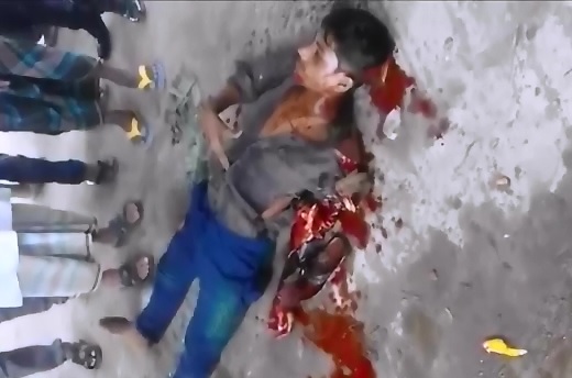 Poor Man in Agony after Arm Ripped off by Train Accident 