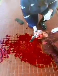 Man Struggles with a Machete Stuck in his Face 