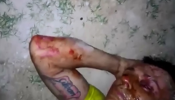 (Look at his Arm) AFTER he got the Visit from the Drug Dealers he Owed Money To 