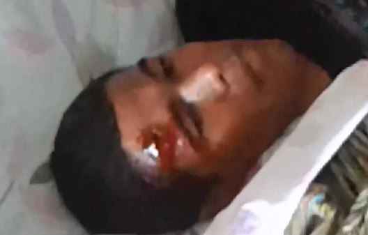 Kid Shot in the Forehead Grasps onto Life and Still Talks 