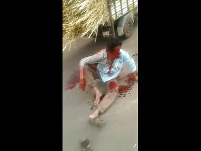 Disfigured after Accident and in Shock 