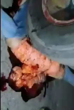 Gruesome Aftermath of Man Crushed by Truck 