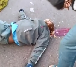 Poor Man lies with Vomit all over Himself after Accident 