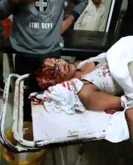 Morgue Pictures of Tiny Dancer killed on Stage in Brazil 