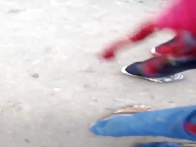 Legs Horrifically Mangled sits in Shock 