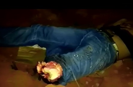 Man with Leg Split in Half waits for Help 