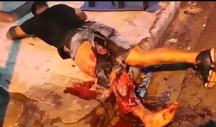 Multiple People are Legless after this Accident 