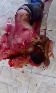 Man was Hacked to Death taking his Final Gasps is Hard to Listen To 