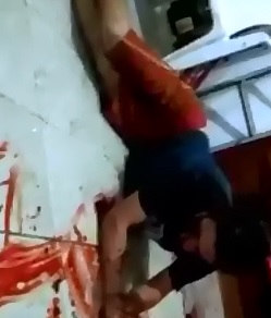 Man Shot in the Eye Can No Longer See..