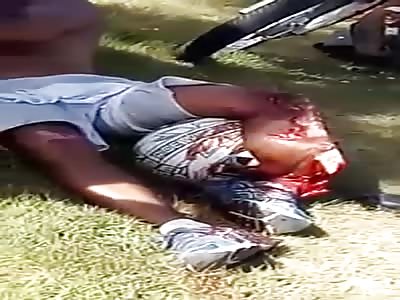 Leg ripped apart over the helmet