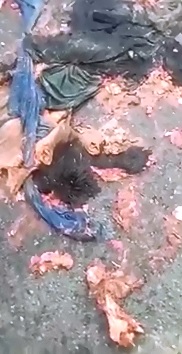 Man Allegedly Hit by an Asteroid...